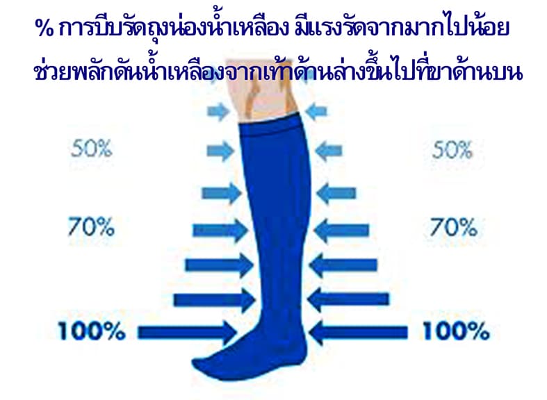 หลักการทำงานของถุงน่องน้ำเหลือง