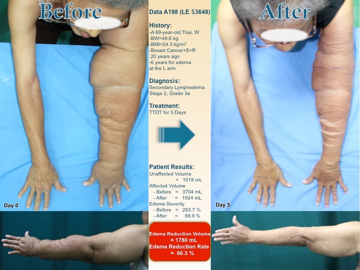 armswell19