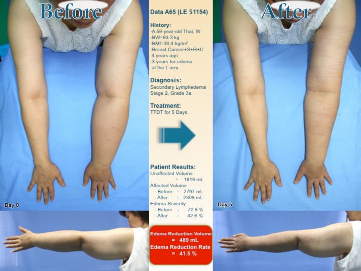 armswell25