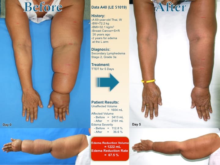 armswell3