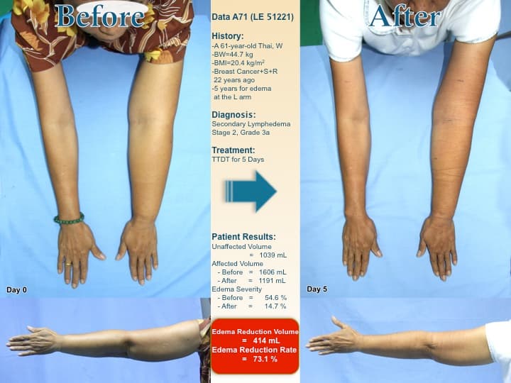 armswell33