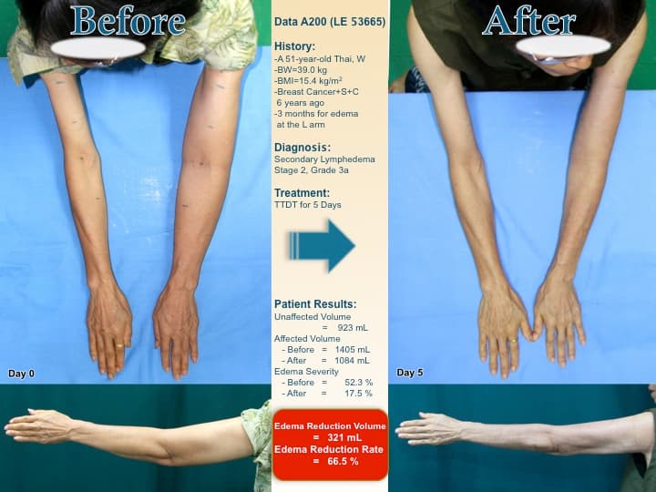 armswell49