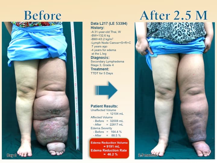 legswell11