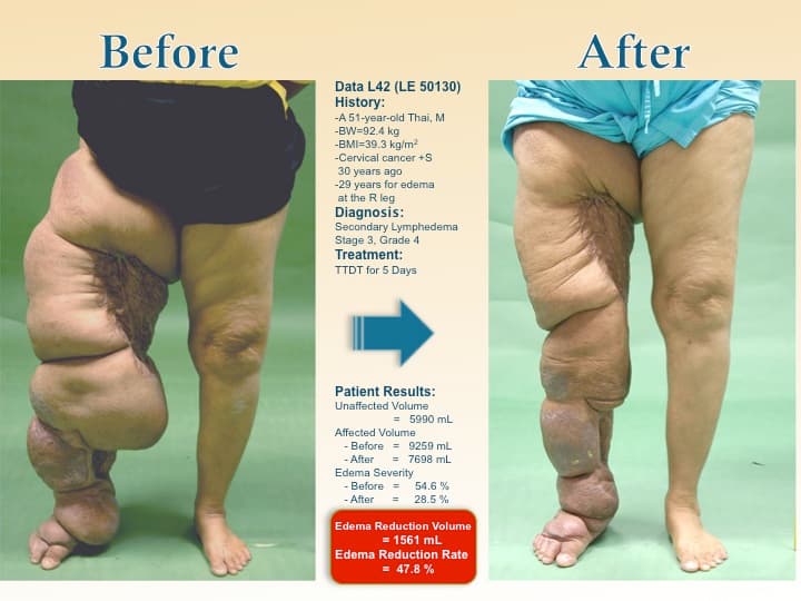 legswell13