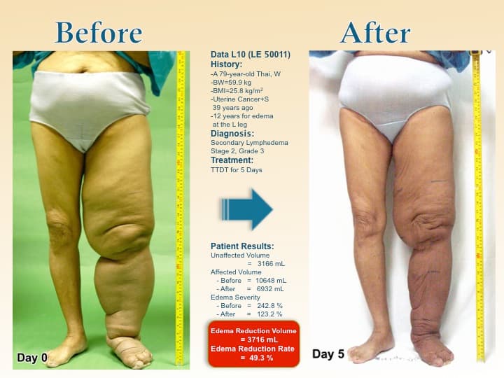 legswell17