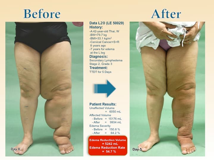legswell19