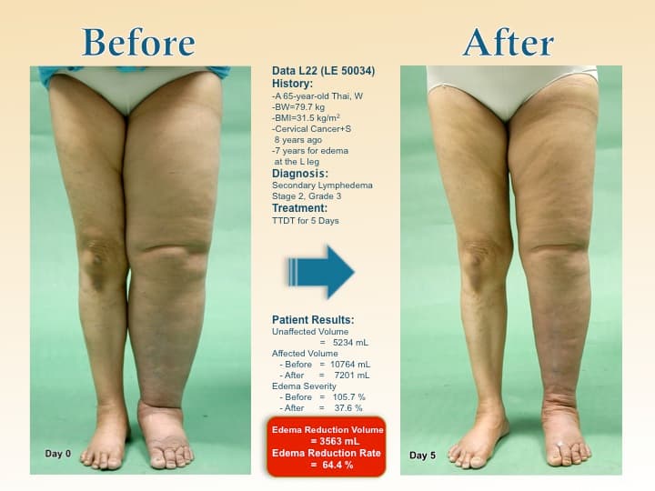 legswell21