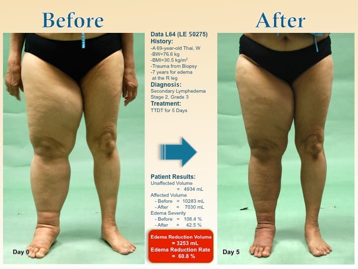 legswell23