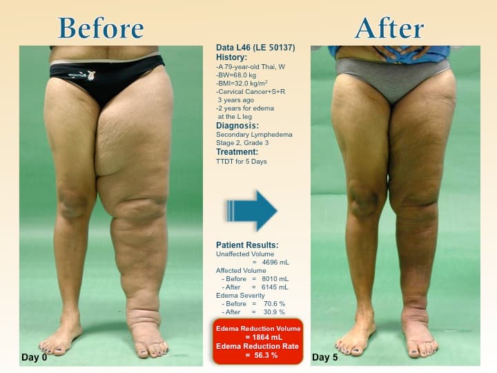 legswell24