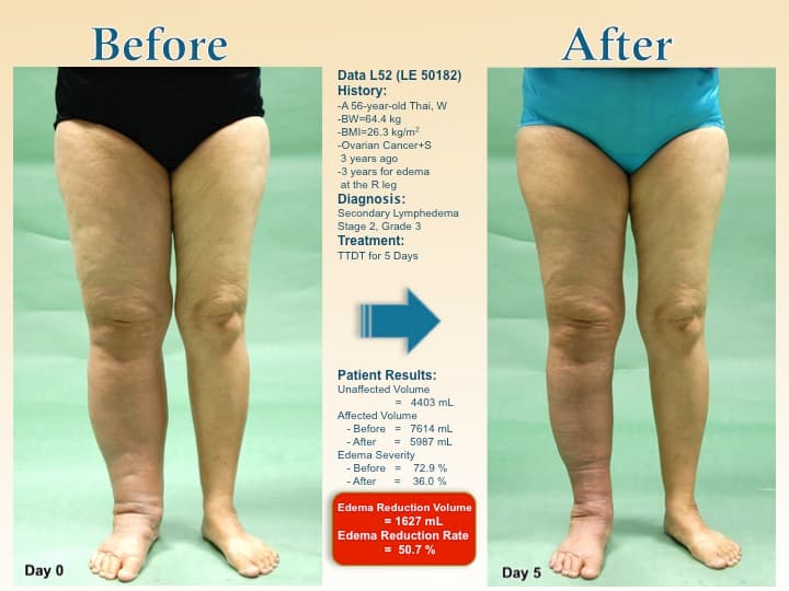 legswell26