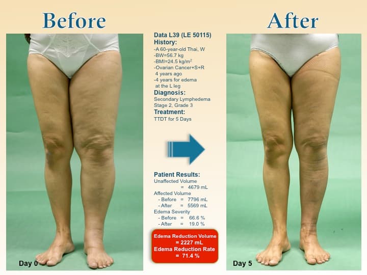 legswell27