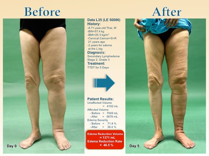 legswell29