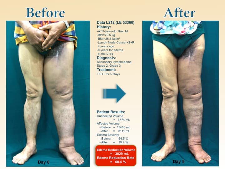 legswell31