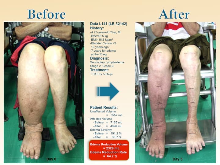 legswell32