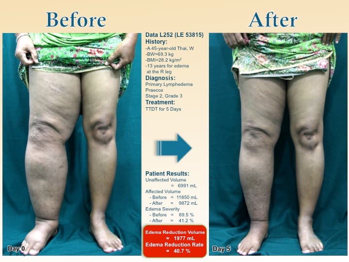 legswell33