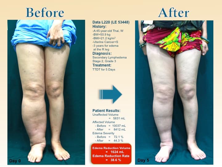 legswell34