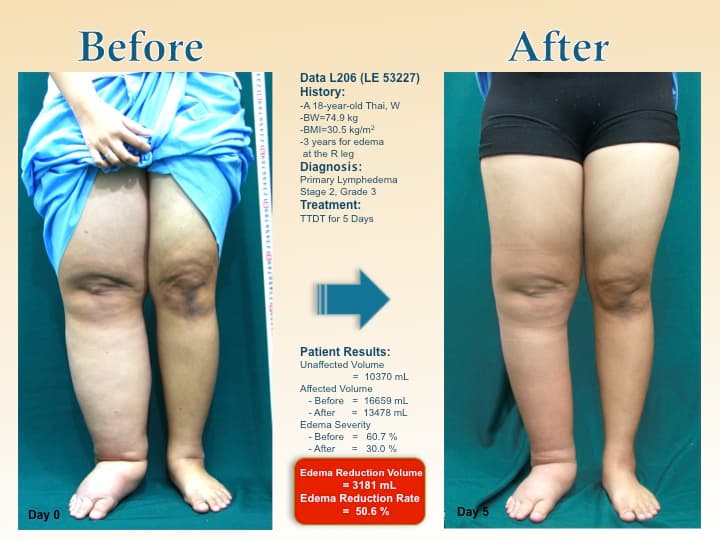 legswell36
