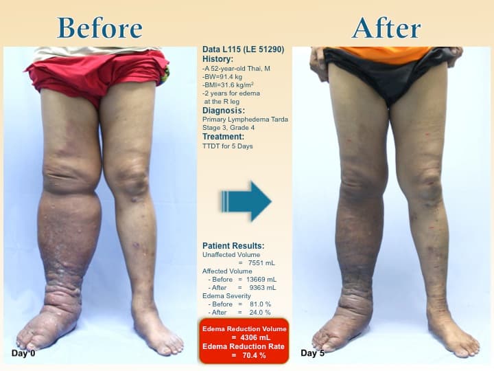 legswell37