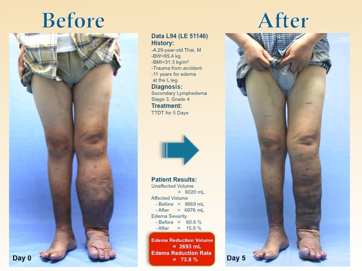 legswell39