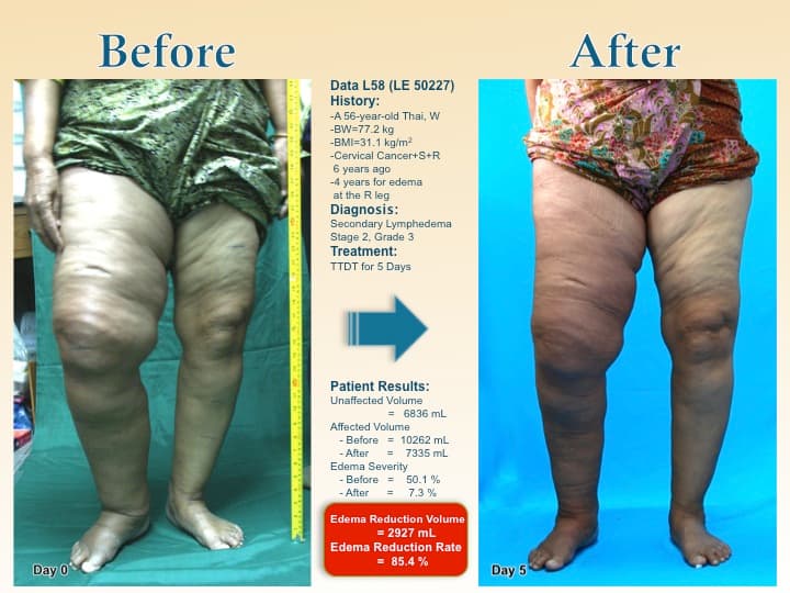 legswell42