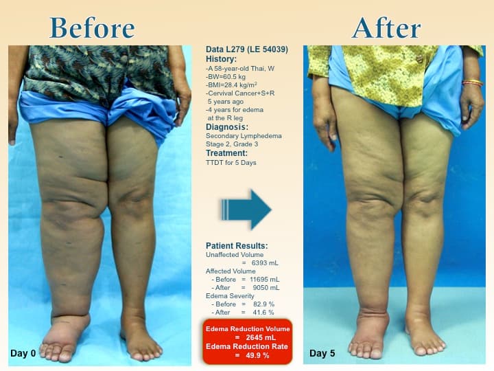 legswell44