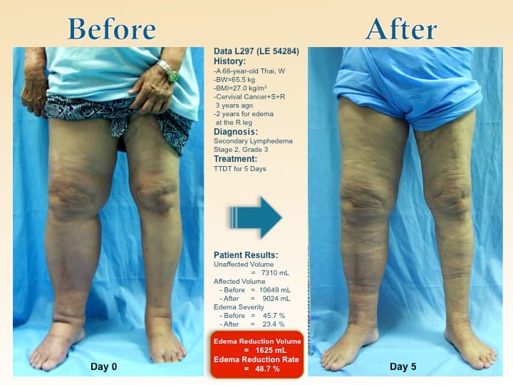legswell46