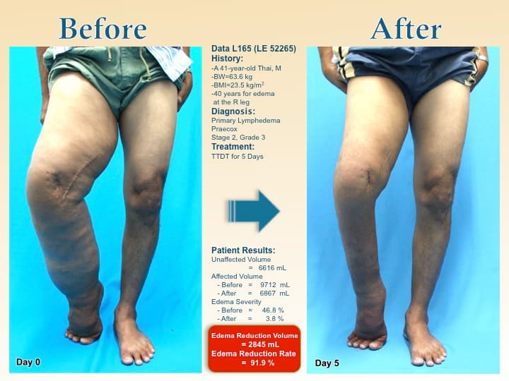 legswell47