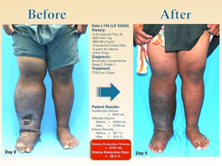 legswell49