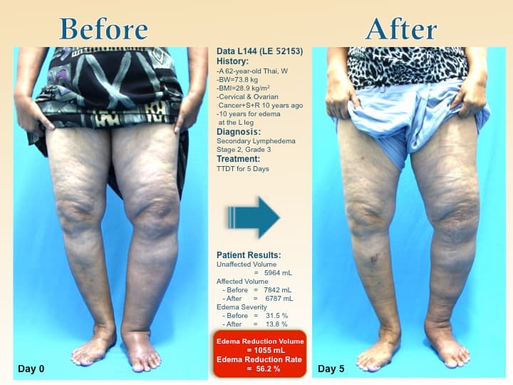 legswell51