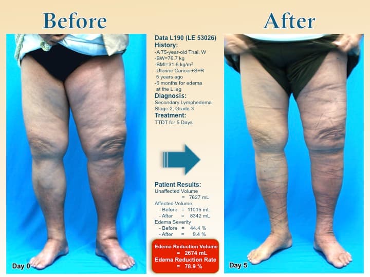 legswell52