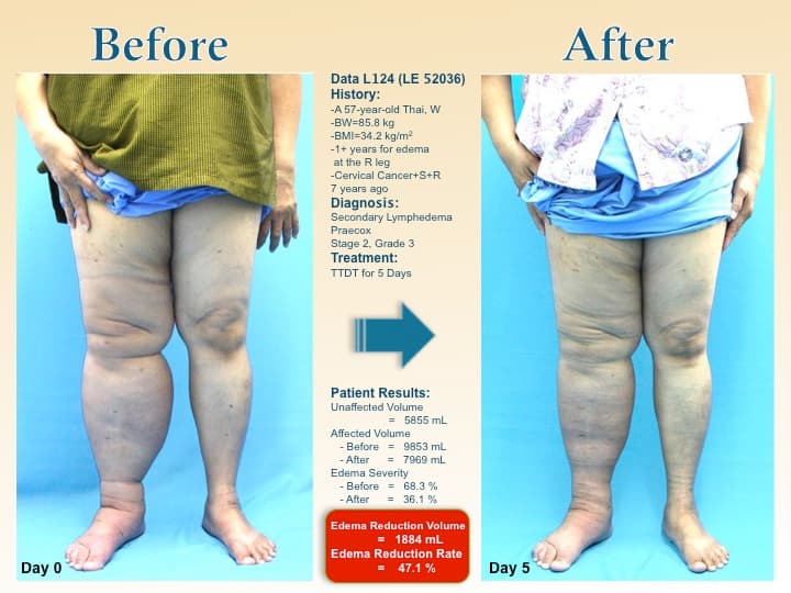 legswell54