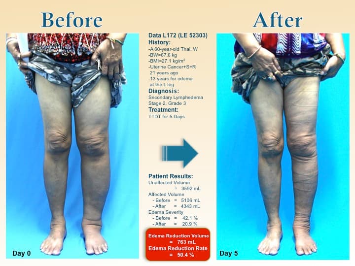 legswell55