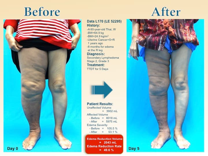 legswell56