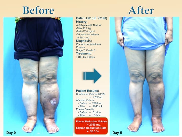 legswell57