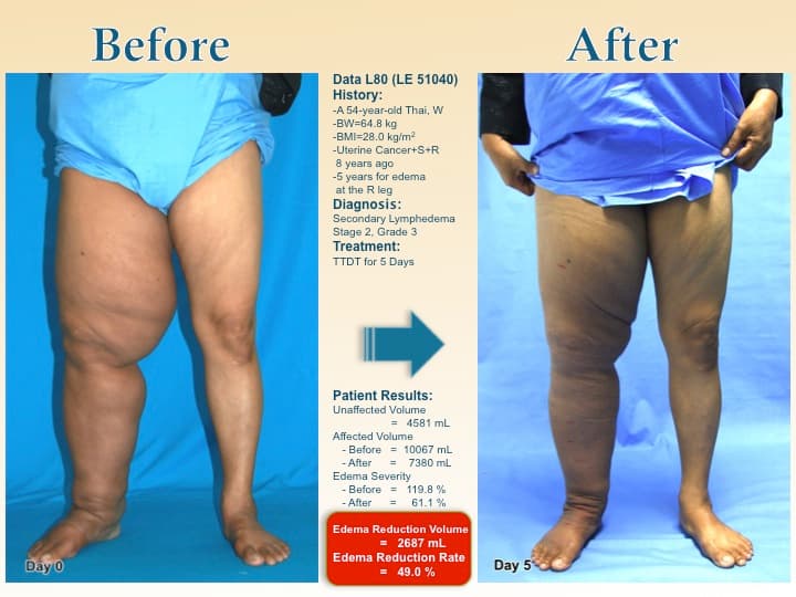 legswell58