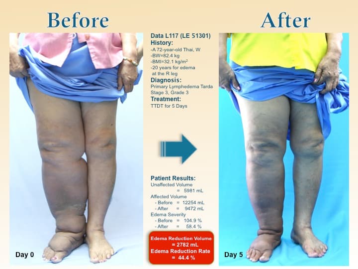 legswell59