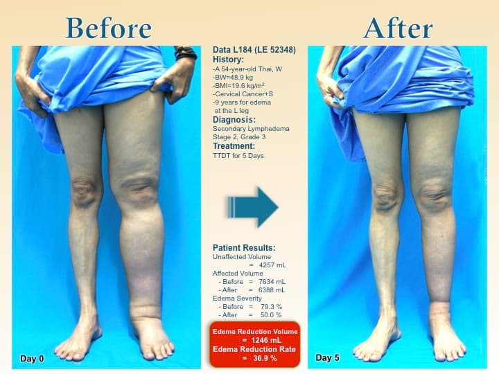 legswell60