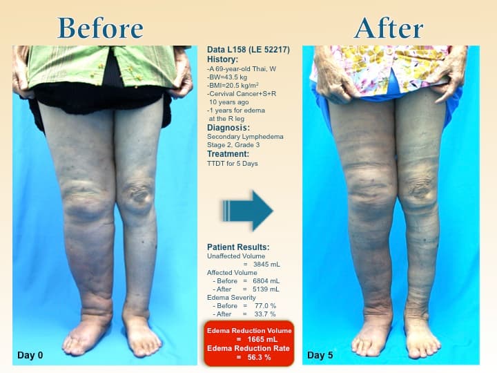 legswell61