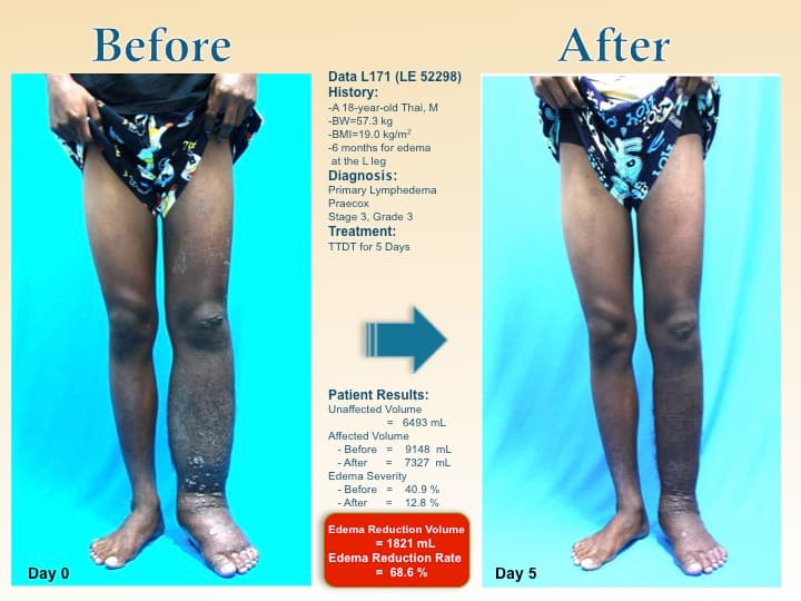 legswell62