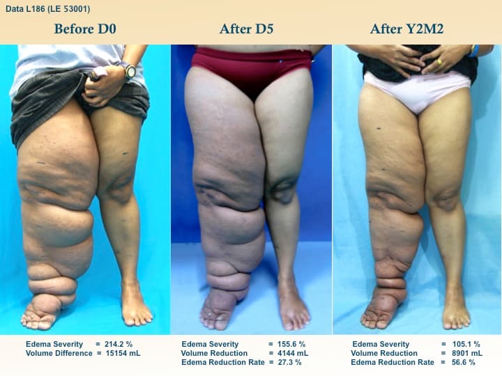 legswell7