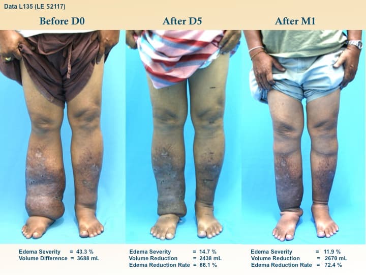 legswell8