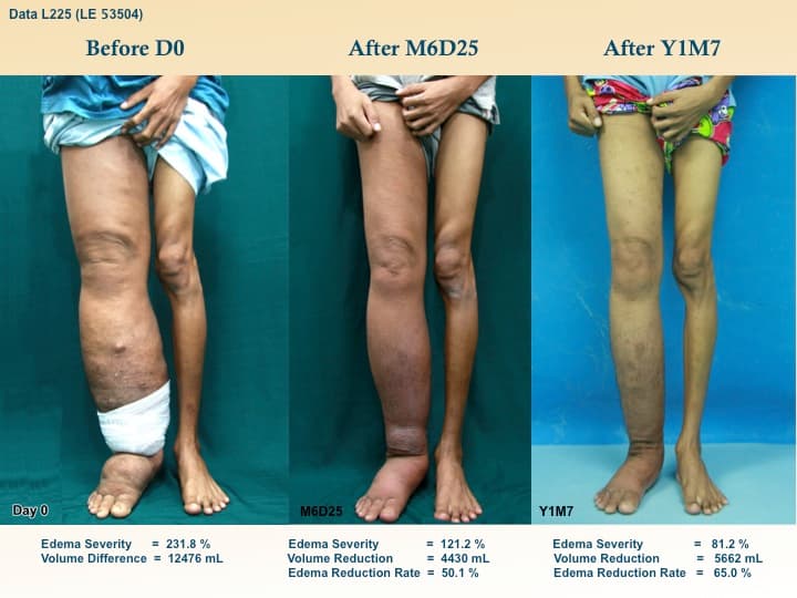 legswell9