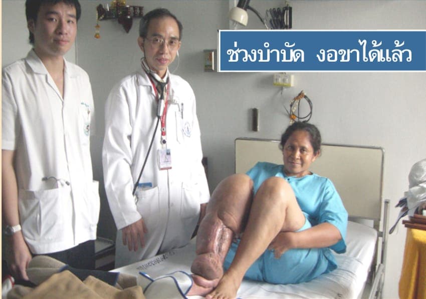 ภาพผู้ป่วยตัวอย่าง 2