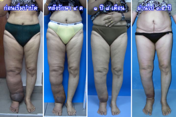 goodlymphcenter10