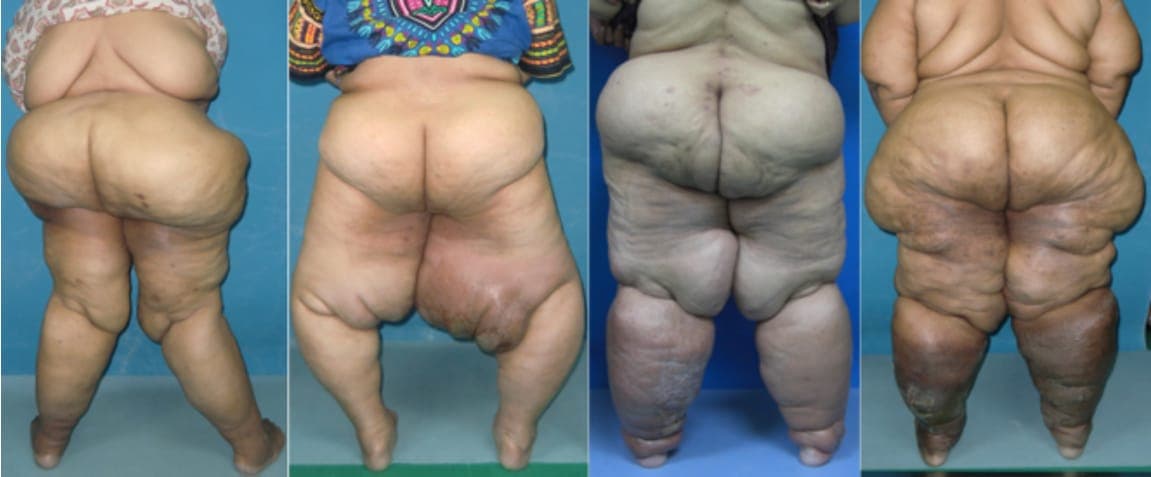 goodlymphcenter5